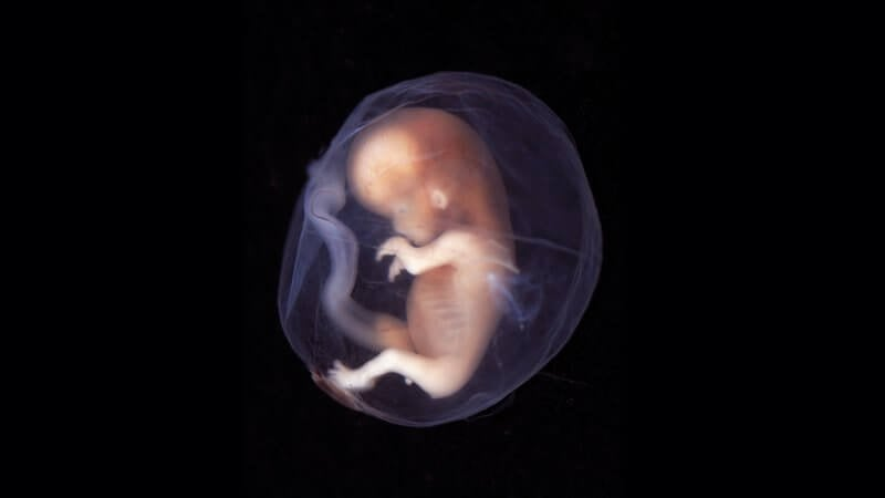 UK Researchers Create A Human Embryo Model With A Brain And A Beating Heart.